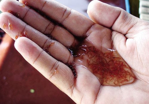 Mexico: Sử dụng noãn cầu Artemia làm thức ăn cho ấu trùng tôm