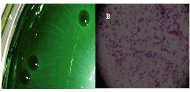 kiem-soat-vi-khuan-vibrio-01